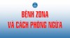 Bệnh zona và cách phòng ngừa
