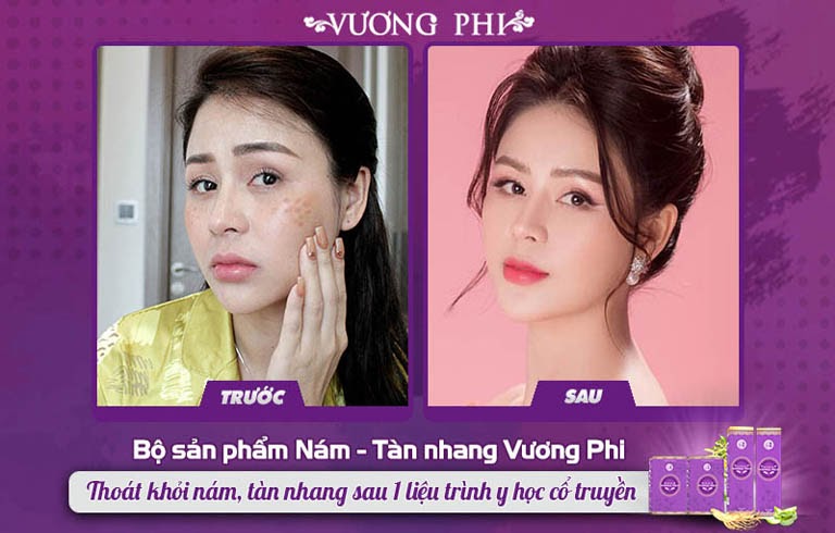 dien vien luong thu trang tri nam bang vuong phi NNYV