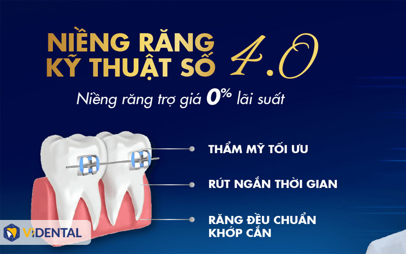 nieng rang tra gop tai vidental