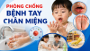 THÔNG TIN DÀNH CHO BÁO CHÍ: Chủ động phòng bệnh tay chân miệng khi bước vào thời điểm nguy cơ gia tăng