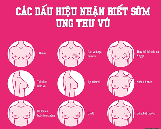 Tầm soát ung thư vú