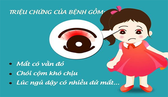 Tuyên truyền bệnh đau mắt đỏ